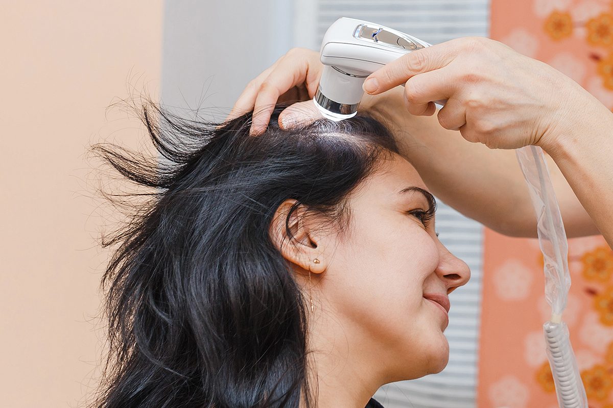 Femmes et perte de cheveux les 10 meilleurs remèdes et traitements