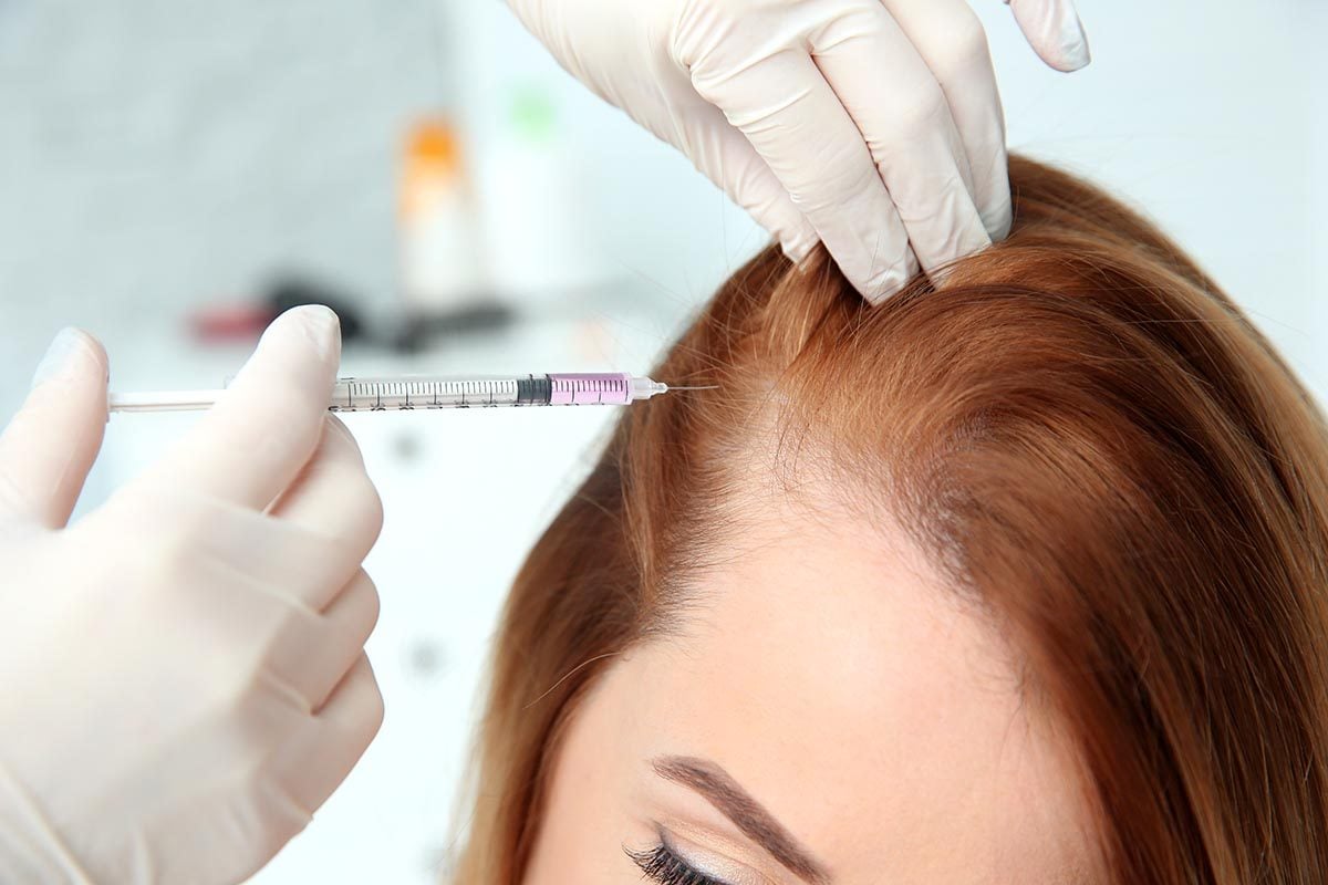 Femmes et perte de cheveux les 10 meilleurs remèdes et traitements