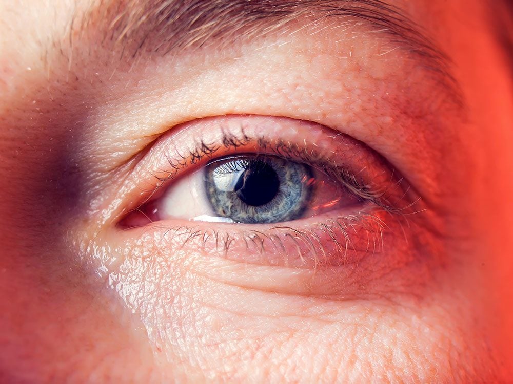 Maladie des yeux : le guide complet pour tout savoir