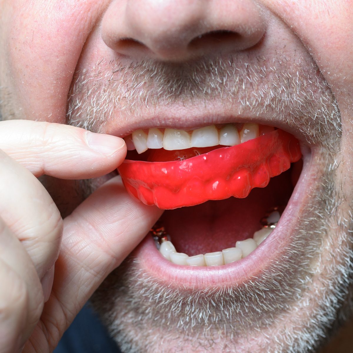 Arrêter de serrer les dents, grincer les dents : 5 exercices