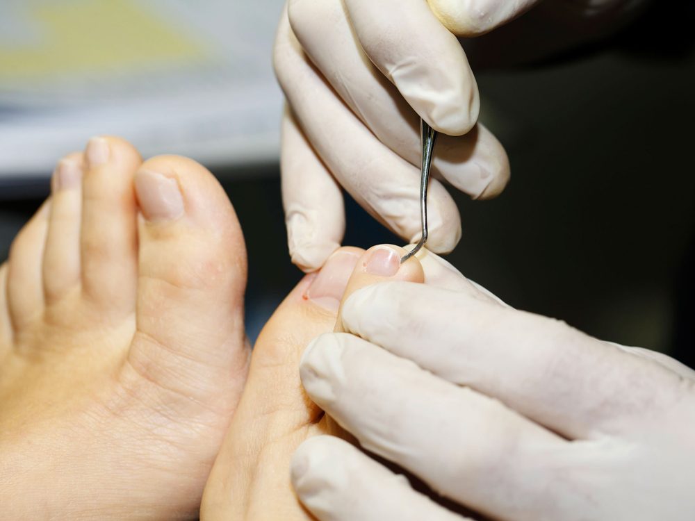 Maladies Des Signes Et Symptômes Visibles Sur Les Pieds